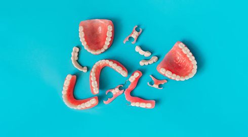 Partial denture with metal clasps against neutral background
