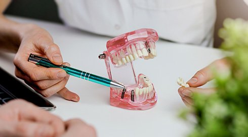 a model of a mouth showing how dental implants work