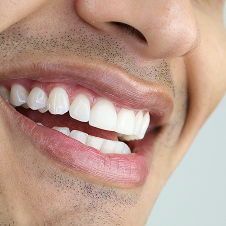 Closeup of man smiling with white teeth