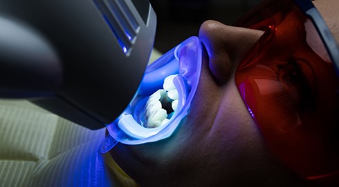 Man having teeth whitened in dental office